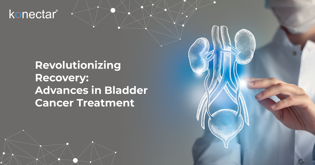 Advances in Bladder Cancer Treatment